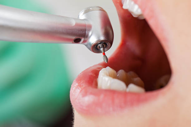 Best Emergency Dental Care for Trauma or Injury in Perryville, MD